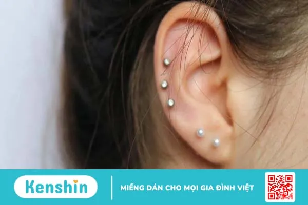 Viêm sụn vành tai là gì? Cần cẩn thận với các triệu chứng gây viêm 1