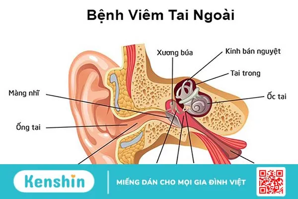 Mô phỏng ống tai của bệnh nhân viêm tai ngoài