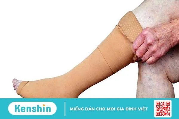 Viêm tĩnh mạch: Nguyên nhân, triệu chứng và cách điều trị bệnh 4