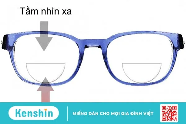 Viễn thị có cần đeo kính không? 4