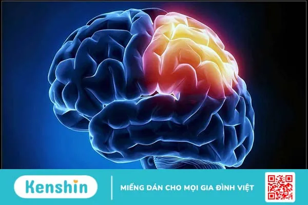 Vỡ xương sọ: Nguyên nhân, triệu chứng và phương pháp điều trị bệnh 1