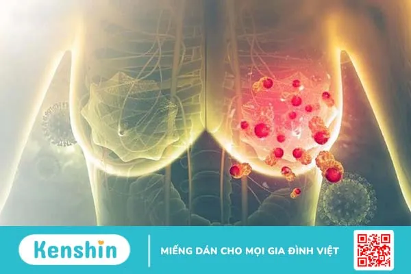 Xạ trị có nguy hiểm không? Tác dụng phụ của xạ trị đối với bệnh nhân ung thư 3