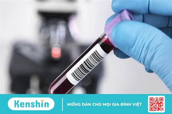 XÉT NGHIỆM AMH CÓ Ý NGHĨA GÌ ĐỐI VỚI SỨC KHỎE SINH SẢN NỮ GIỚI 2