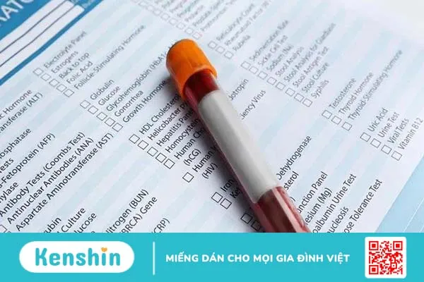 Mục đích và phương pháp xét nghiệm Anti Ds DNA 1