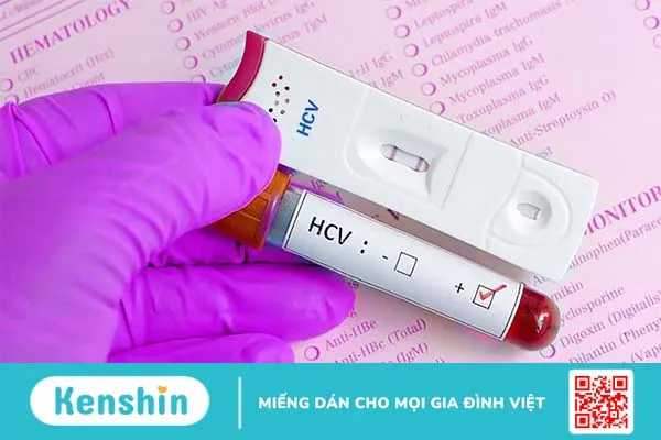 Xét nghiệm Anti HCV tìm kháng thể chống virus viêm gan C 2