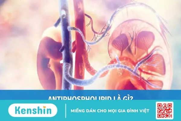 Xét nghiệm anti phospholipid igm là gì? -1