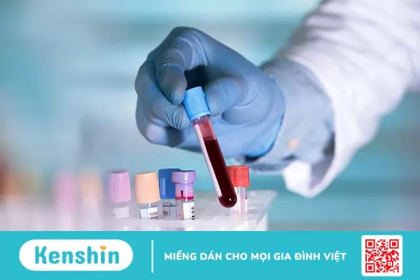 Xét nghiệm CMV phát hiện bệnh do virus Cytomegalo gây ra 3