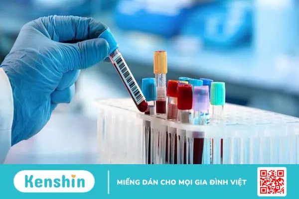 Xét nghiệm định lượng Phospho cho biết điều gì? 4