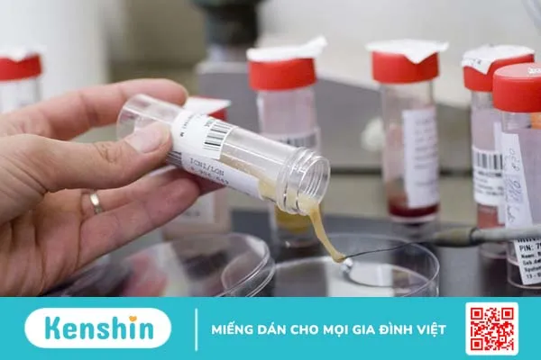 Xét nghiệm đờm AFB và những thông tin cần biết 1