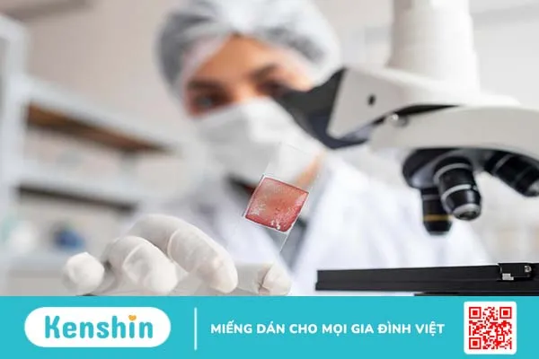 Xét nghiệm GPB là gì? Ý nghĩa của xét nghiệm GPB trong y học không phải ai cũng biết 2