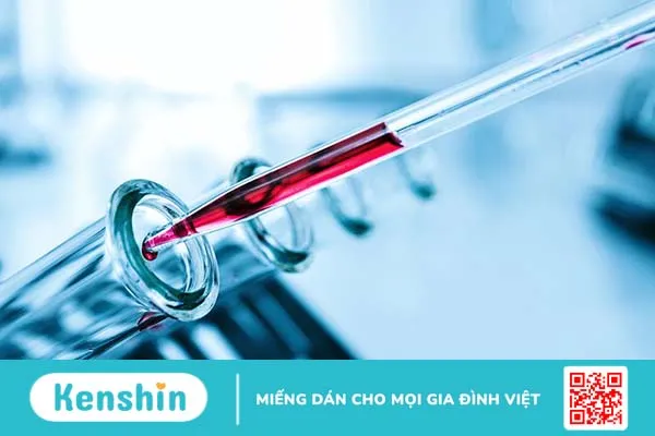 Xét nghiệm H. pylori IgG cho kết quả dương tính có ý nghĩa gì?