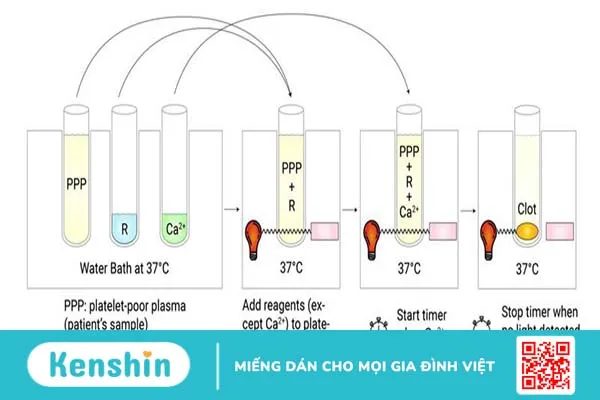 Xét nghiệm TCK được thực hiện như thế nào? 4