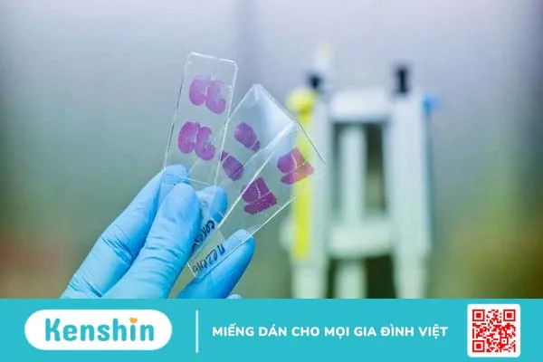 Xét nghiệm vi khuẩn nhuộm soi là gì - Bạn đã biết chưa? 3