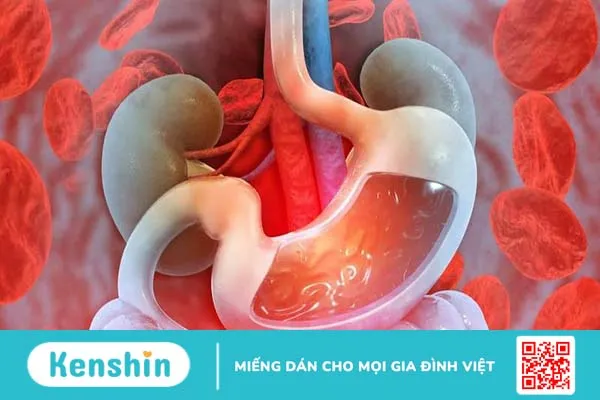 Xơ hóa gan là gì? Dấu hiệu và điều trị 4