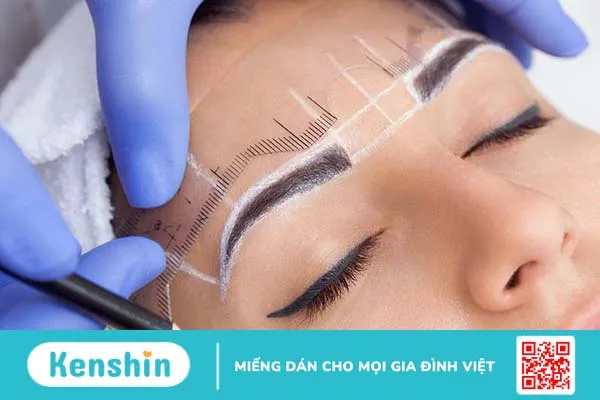 Xoá xăm chân mày bằng laser có hiệu quả không? 2