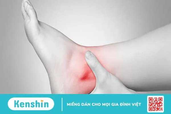 3 bài tập tăng cường sức mạnh cho cổ chân sau chấn thương