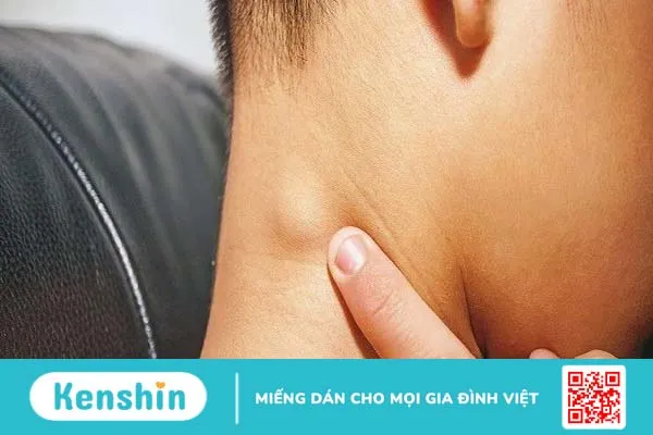 Ăn gì để tiêu hạch? Chế độ dinh dưỡng cho người bị nổi hạch