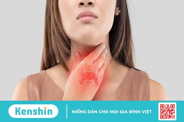 Bạn có biết: Nguyên nhân gây ra bệnh bướu cổ basedow là gì?