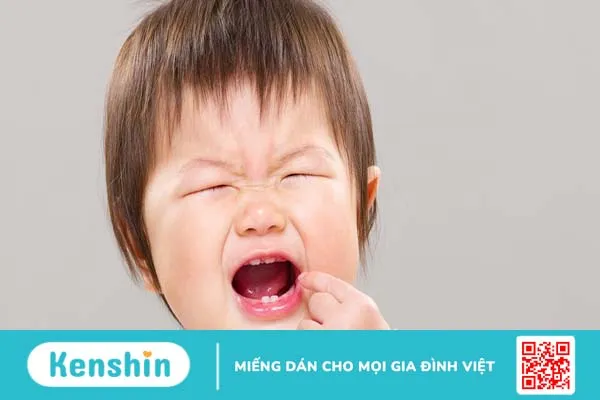 Bệnh răng miệng ở trẻ em: Nguyên nhân và cách điều trị