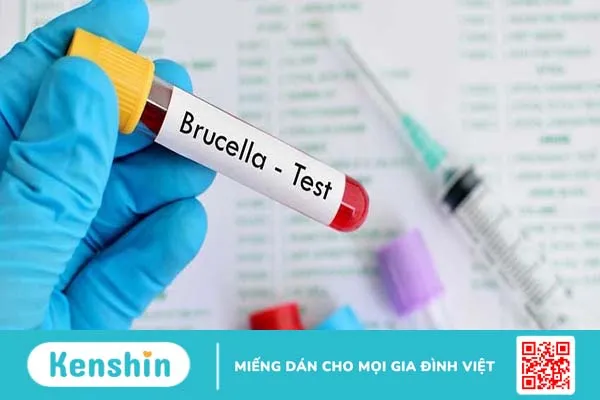 Bệnh truyền nhiễm Brucella có nguy hiểm không?