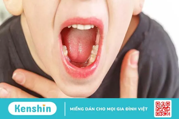 Bệnh viêm VA ở trẻ em có nguy hiểm không?