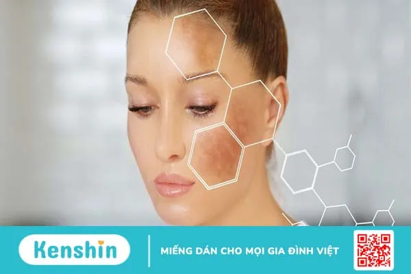 Bí kíp dưỡng da cho bà bầu không nên bỏ lỡ