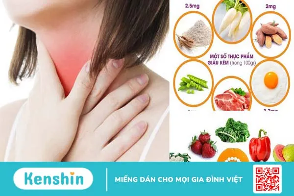 Bị nấm họng kiêng ăn gì cho nhanh khỏi?