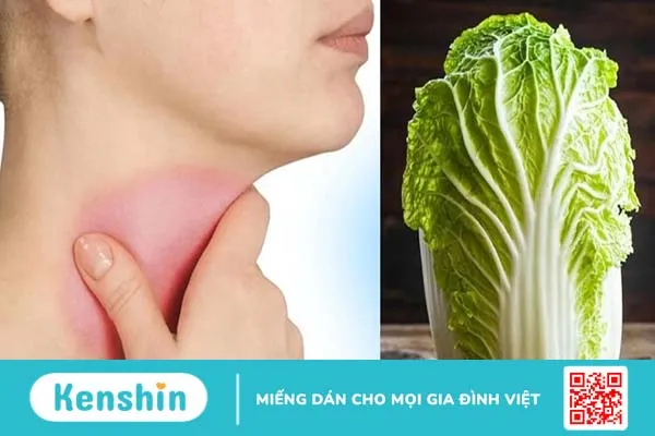 Bướu cổ ăn cải thảo được không? Thực phẩm nên ăn và tránh khi bị bướu cổ