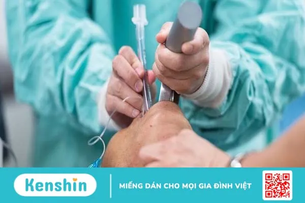 Các bước tiến hành nội soi phế quản dưới gây mê