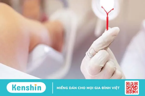 Các dấu hiệu nhận biết khi tuột vòng tránh thai và cách xử lý