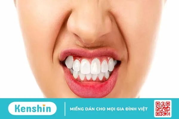 Các loại răng vẩu thường gặp và cách khắc phục