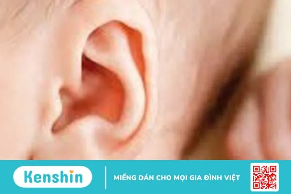 Cách chữa viêm tai giữa dân gian hiệu quả bất ngờ