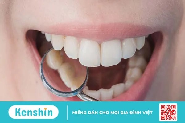 Cách điều trị ung thư nướu răng