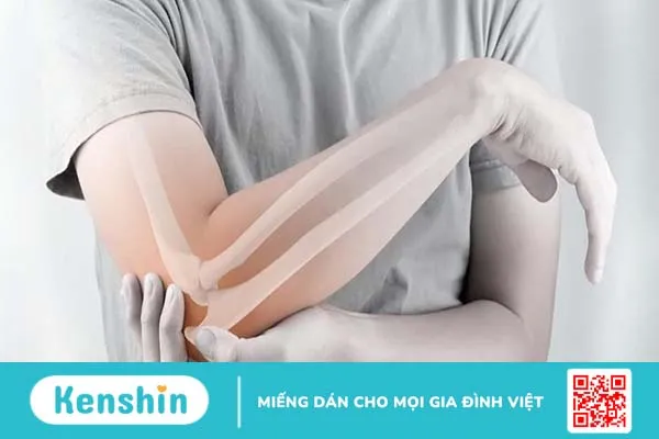 Cách sơ cứu gãy xương cẳng tay hiệu quả