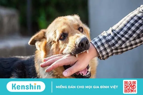 Cách sơ cứu khi bị chó cắn trước khi đến bệnh viện