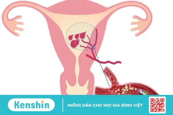 Cách tống sản dịch sau sinh mổ nhanh chóng cho phụ nữ sau sinh