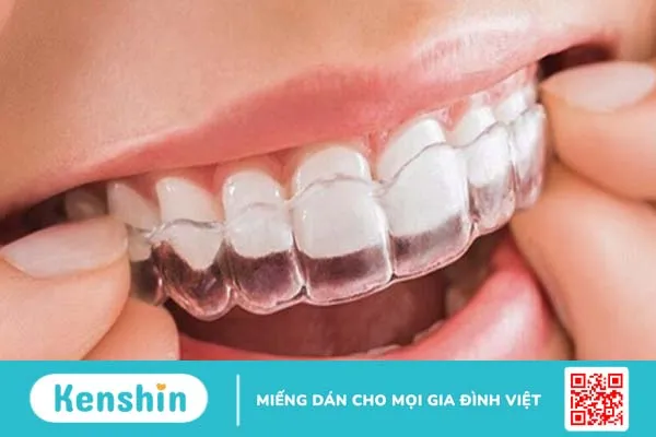 Cách vệ sinh răng miệng sau khi niềng răng như thế nào?