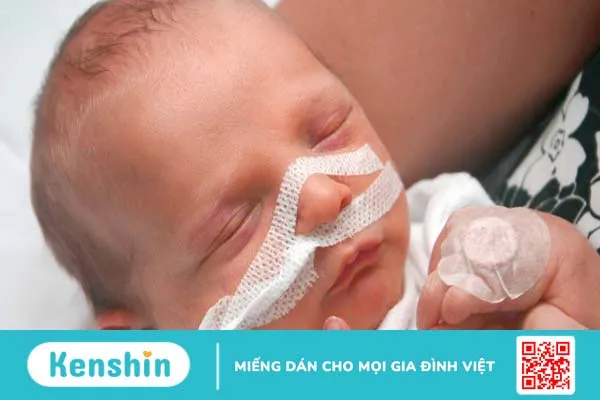 Cẩn trọng với hội chứng suy hô hấp ở trẻ sơ sinh