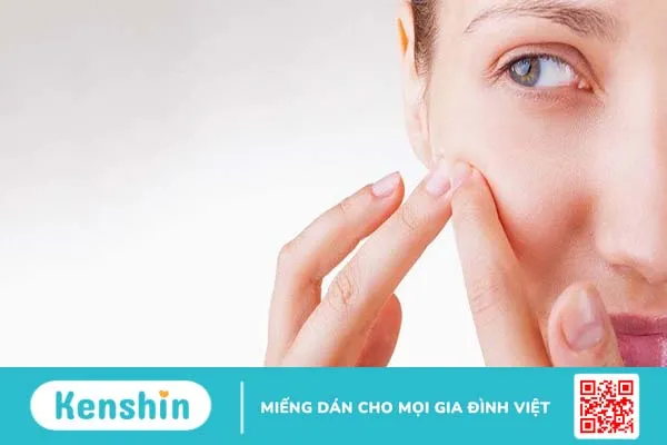 Chảy máu sưng viêm sau khi nặn mụn phải làm sao?