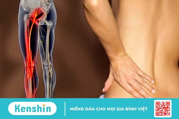 Chèn ép tủy gây liệt: Nguyên nhân, triệu chứng và phương pháp điều trị