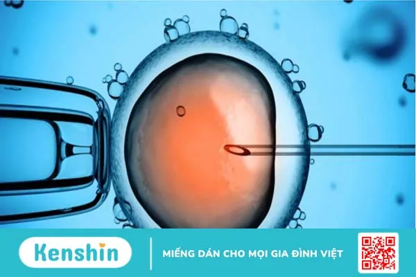 Chi phí thụ tinh ống nghiệm giá bao nhiêu?