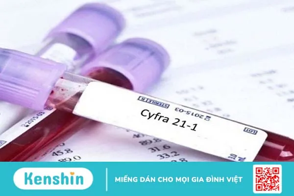 Chỉ số CYFRA 21-1 cobas: Ý nghĩa và vai trò trong chẩn đoán ung thư