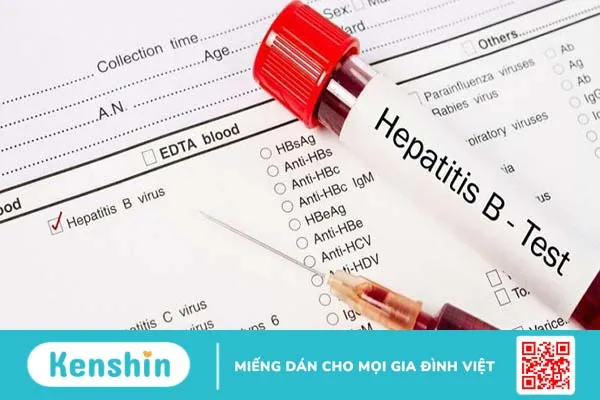 Chỉ số HBV-DNA bao nhiêu là bình thường?