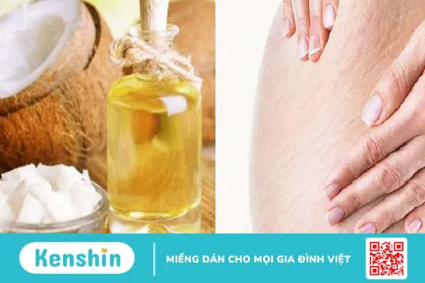 Chi tiết cách trị rạn da sau sinh bằng dầu dừa