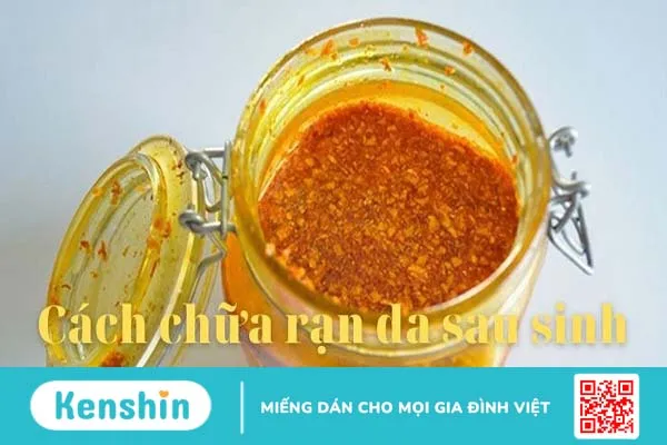 Chi tiết cách trị rạn da sau sinh bằng rượu nghệ