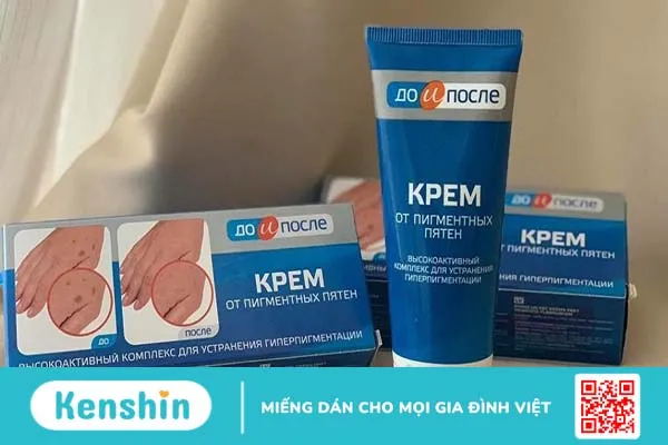 Có nên sử dụng kem trị đồi mồi ở tay Kpem?