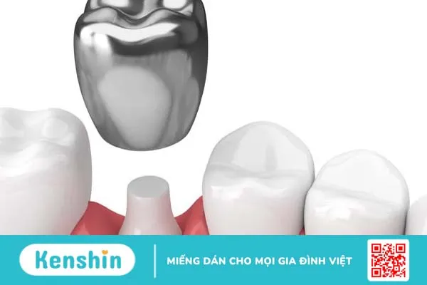 Có nên súc nước muối sau khi bọc răng sứ không? Vì sao?