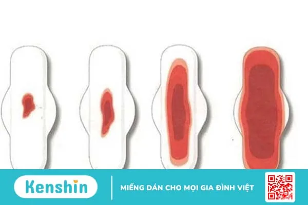 Cường kinh là gì? Nguyên nhân và phương pháp điều trị hiện tượng cường kinh