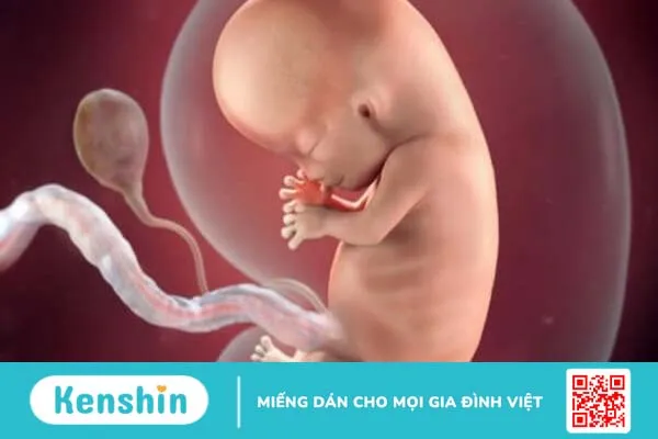 Đa ối khi mang thai có nguy hiểm không? Khi bị đa ối cần làm gì?