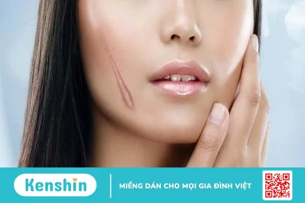 Điểm danh những phương pháp trị sẹo lồi hiệu quả và an toàn